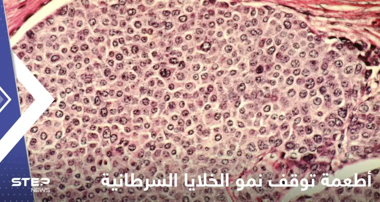 علماء يكتشفون أطعمة توقف نمو الخلايا السرطانية في الجسم وتمنع انتشارها: أخبار