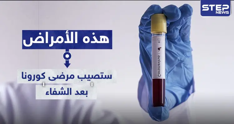 دراسة تكشف الأمراض التي ستصيب مرضى "كورونا" بعد الشفاء من الفيروس: أخبار