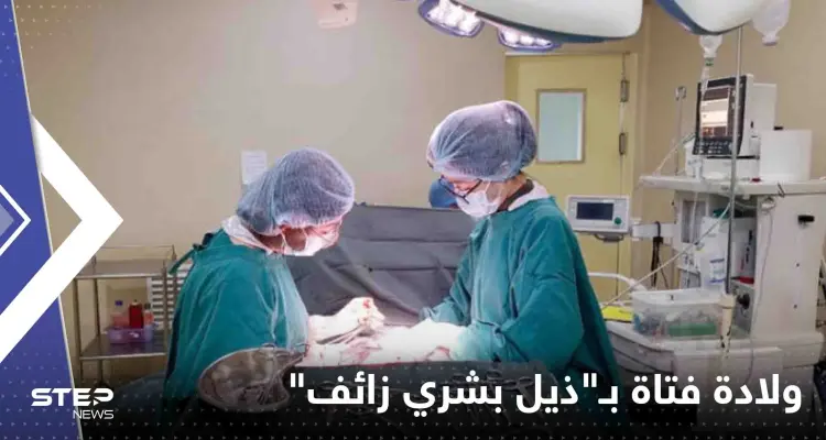 شاهد|| بظاهرة نادرة للغاية.. ولادة فتاة في البرازيل بـ"ذيل بشري زائف": أخبار