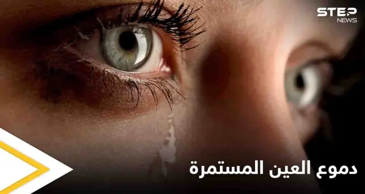 تعرف على أسباب دموع العين المستمرة وطرق علاجها: أخبار