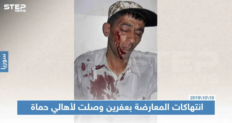 عناصر فيلق الشام يعتدون على نازح من حماة بالضرب المبرح، لهذا السبب: أخبار