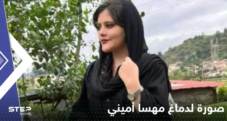 شاهد|| صورة لدماغ مهسا أميني تكشف تفاصيل ما حدث.. وعرض وجوه الجناة لأول مرة: أخبار