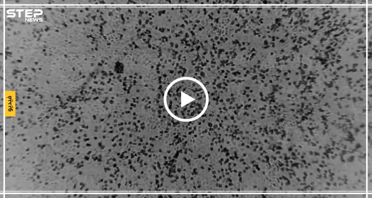 أوّل فيديو يظهر مراحل التطور السريع لفيروس "كورونا".. وعلماء يكتشفون نقطة التحول: أخبار