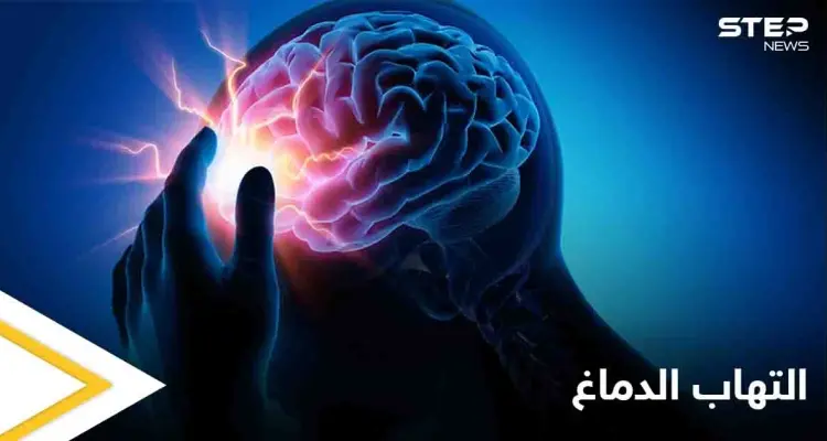 تعرف على مرض التهاب الدماغ ومخاطره الصحية وكيفية الوقاية منه: أخبار