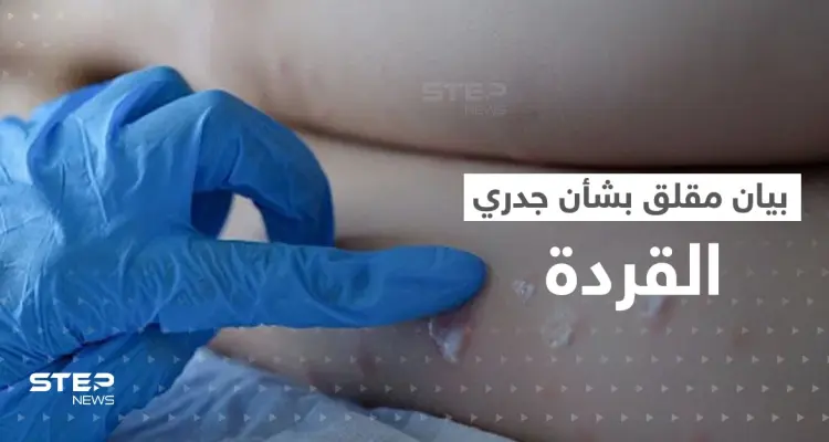 جدري القردة حالة طوارئ دولية.. الصحة العالمية تصدر بياناً "مثيراً للقلق": أخبار