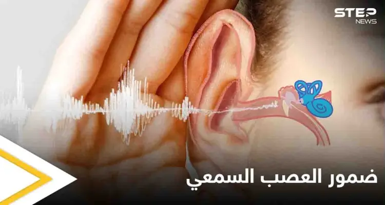 تعرف على مرض ضمور العصب السمعي أسبابه وأعراضه وطرق العلاج: أخبار