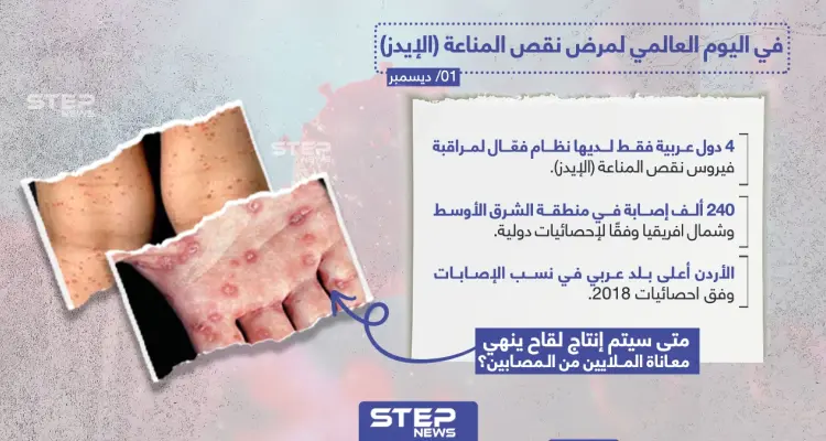 متى سيتم انتاج لقاح ينهي معاناة مرضى الإيدز؟: أخبار