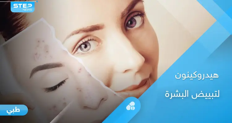 دواء هيدروكينون لتبييض البشرة وإزالة التصبغات.. طرق الاستخدام والآثار الجانبية إليك أهم المعلومات: أخبار