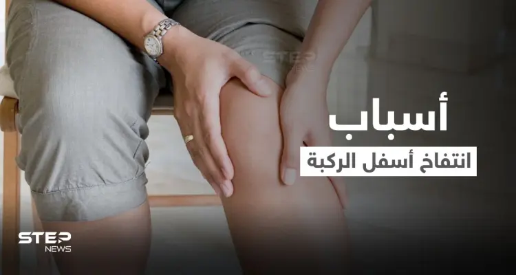 تعرف على أسباب انتفاخ أسفل الركبة وطرق العلاج: أخبار
