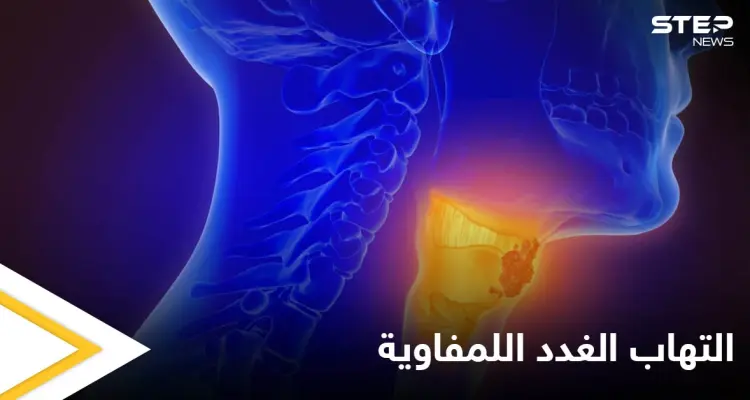 أسباب التهاب الغدد اللمفاوية و أهم طرق علاجها في المنزل: أخبار