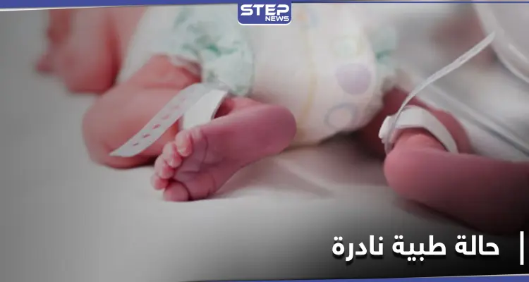 حالة طبية نادرة في بريطانيا.. أم تلد ثلاثة أطفال من رحمين مختلفين في آن واحد: أخبار