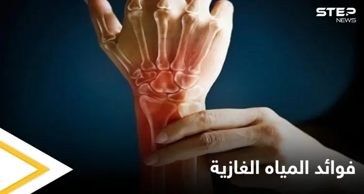 منها تعزيز صحة العظام.. تعرف على فوائد المياه الغازية ومضارها الجانبية: أخبار