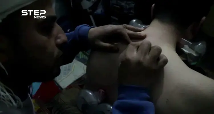 تعرف على الحجامة في مدينة الباب بريف حلب: أخبار