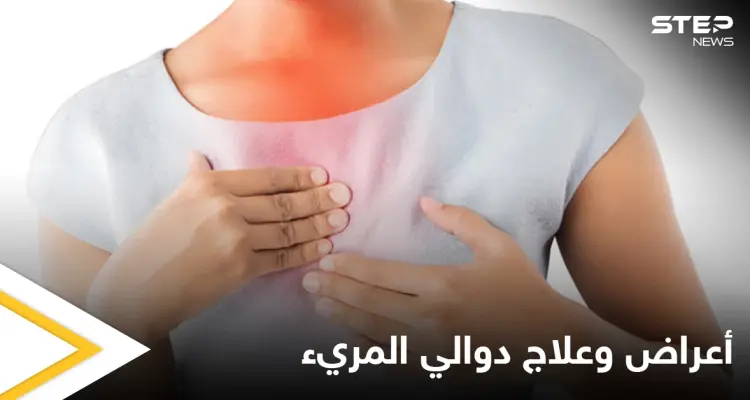 ما هي دوالي المريء وأعراضها وطرق علاجها إليك أهم المعلومات: أخبار