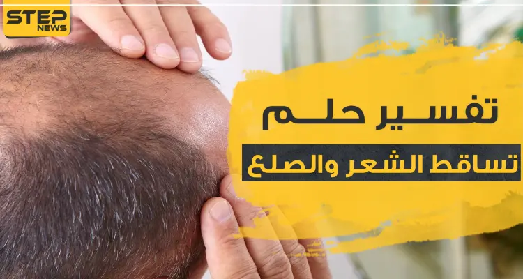 تفسير حلم تساقط الشعر والصلع بحسب ابن سيرين للحامل والمتزوجة والعزباء: أخبار