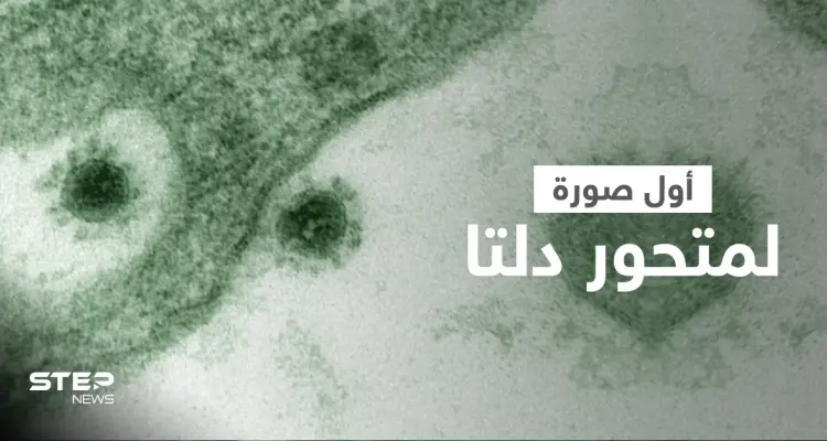 شاهد مجهر إلكتروني يلتقط أول صورة لـ متحور دلتا ينمو كخلايا القرد الأفريقي (صورة): أخبار