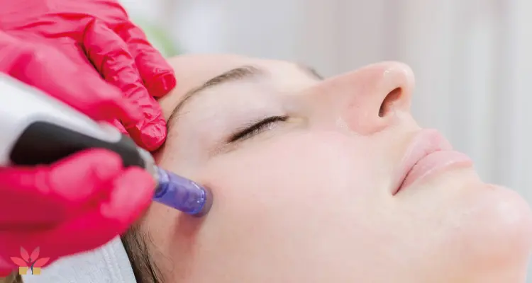 التقشير الكريستالي للبشرة.. أنواعه وطرق العملية مع التكلفة و الأسئلة الشائعة: أخبار