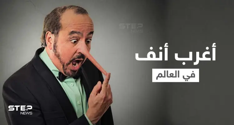 شاهد|| "أرسل الله ملاكاً للاعتناء بي".. صاحب أغرب أنف في العالم يكشف كيف عاد شكل وجهه لطبيعته: أخبار