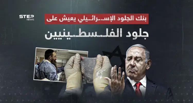 أثار الجدل في وسط حرب غـ..ـزة… ما هو بنك الجلد الإسرائيلي: أخبار