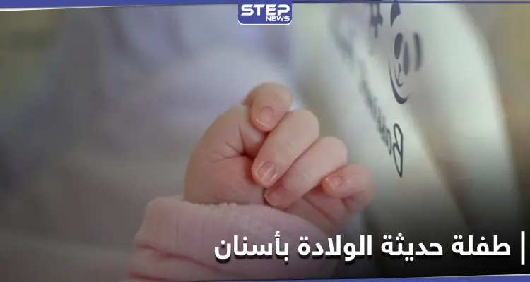 شاهد|| طفلة حديثة الولادة تملك أسناناً.. حالة طبية نادرة في مصر: أخبار