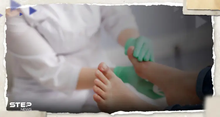 علامات على القدمين إذا شاهدتها يجب مراجعة طبيب لأنها "إنذار": أخبار