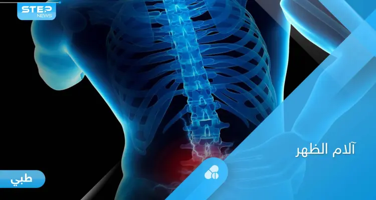 أسباب آلام أسفل الظهر وتأثيرها على الساقين وطرق الوقاية منها: أخبار