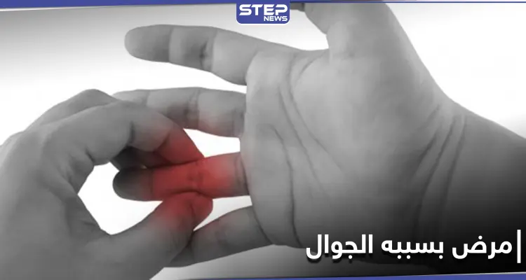 فرط استخدام الهاتف المحمول قد يسبب التهاب مفاصل الأصابع.. إليك طريقة تفاديه: أخبار