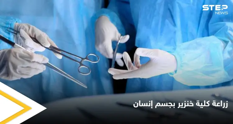 تجارة الأعضاء البشرية إلى زوال بعد نجاح زراعة كلية خنزير في جسم إنسان لأول مرة في التاريخ: أخبار