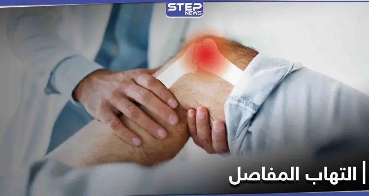 تعرف على أفضل الطرق لعلاج التهاب المفاصل وأسبابه والأعراض الشائعة له: أخبار