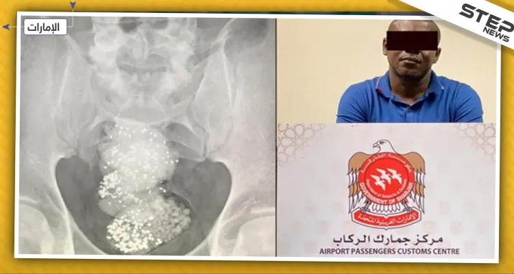 السلطات الإماراتية تلقي القبض على "مهرّب" أخفى الألماس في أحشائه: أخبار