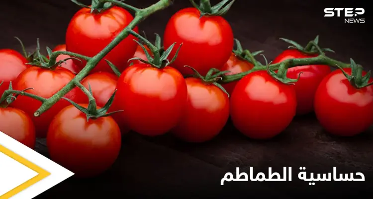 ما هي حساسية الطماطم وهل هي خطيرة تعرف إلى أهم المعلومات عنها: أخبار