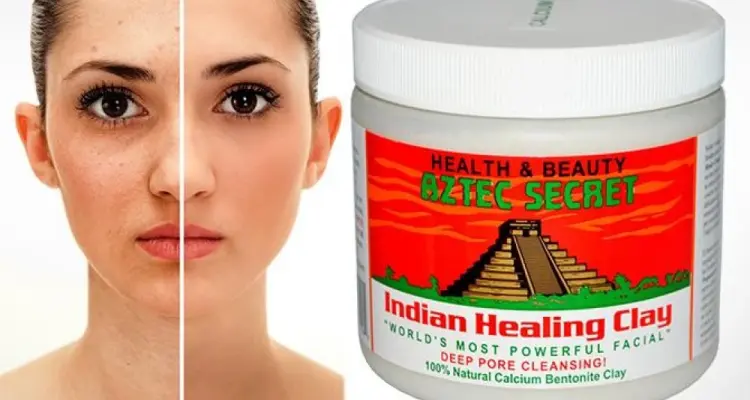 ماسك الطين الهندي لتنظيف البشرة والرؤوس السوداء والحبوب: أخبار