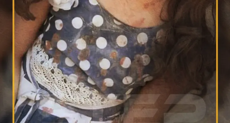 بثوب العيد مصاب وشهيد!!: أخبار