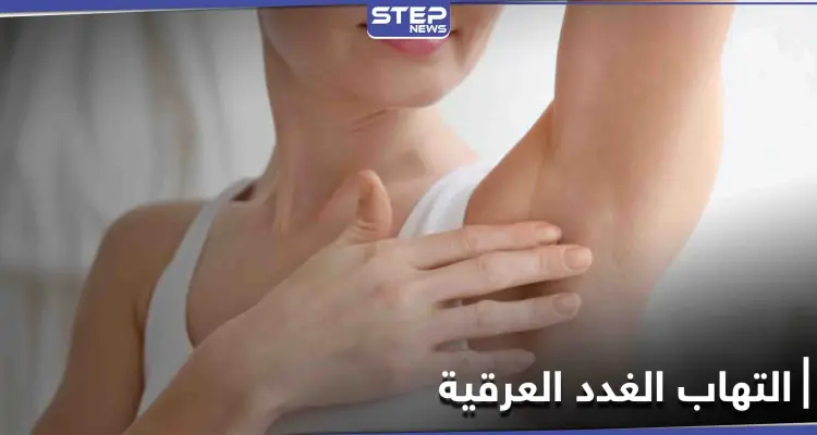 متى يحتاج التهاب الغدد العرقية إلى الجراحة تعرف إلى أعراضه وطرق العلاج: أخبار
