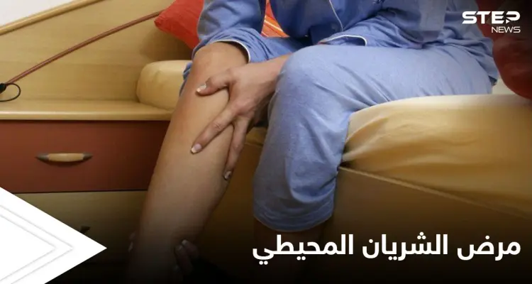 مرض الشريان المحيطي مشكلة صحية تصيب الأطراف وتتسبب بضعفها تعرف عليه: أخبار