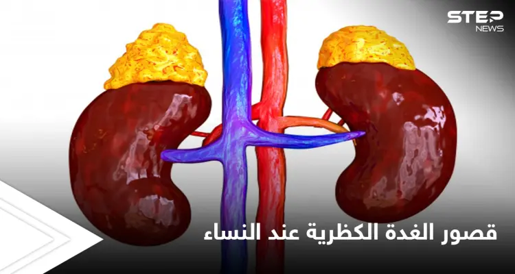 التعايش مع المرض إحدى طرق العلاج.. خطورة قصور الغدة الكظرية عند النساء وأعراضه الشائعة: أخبار
