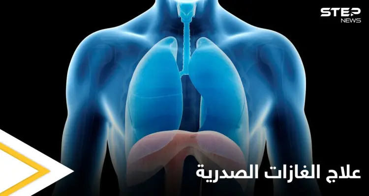 علاج الغازات الصدرية في المنزل وعلاقتها بآلام القلب إليك أهم المعلومات: أخبار