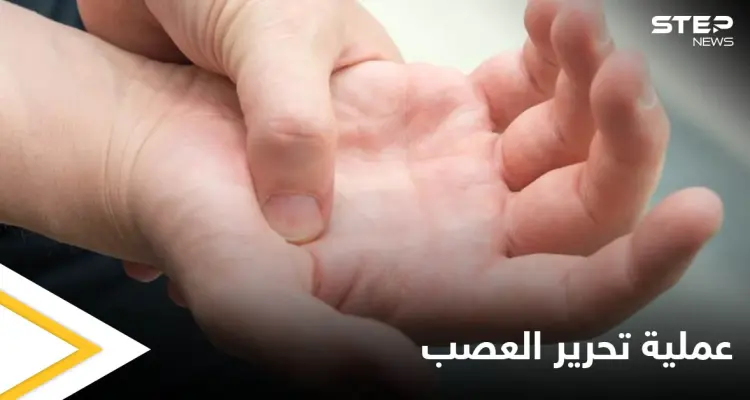 عملية تحرير العصب.. متى يجب إجراؤها وأنواعها إليك أهم المعلومات: أخبار