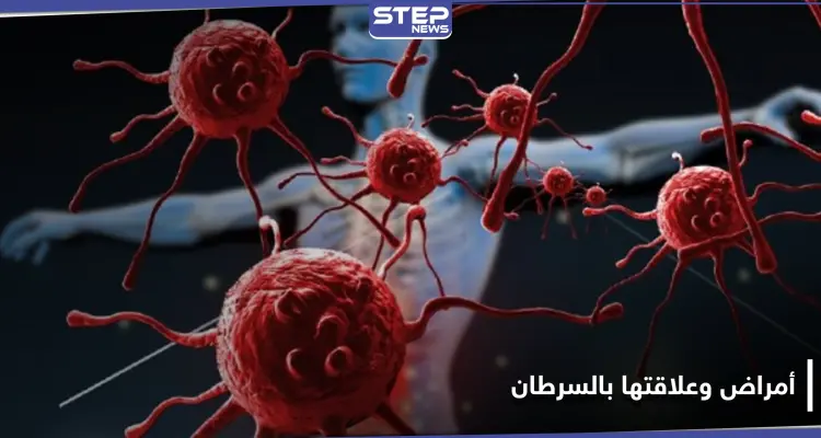 أمراض تسبب تطور السرطان ويمكن أن تسبب في نشأته.. فأحذرها وحاول معالجتها فوراً: أخبار