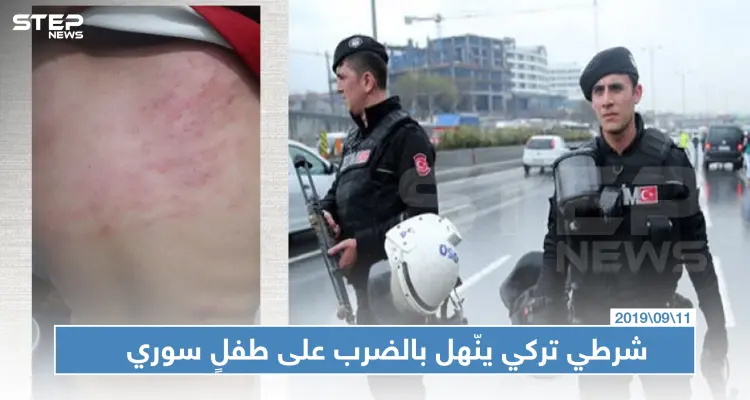 شرطي تركي ينّهل بالضرب على طفلٍ سوري يعمل والأخير يردد "لا أحد يحبنا": أخبار