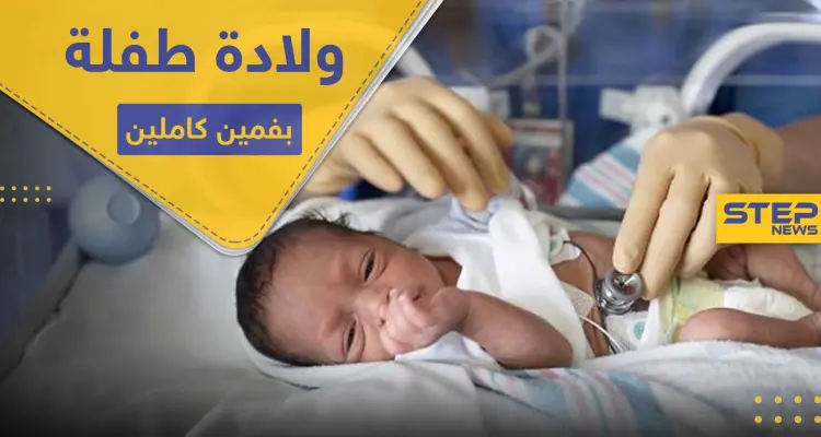 شاهد|| ولادة طفلة بفمين كاملين في حالة طبية نادرة: أخبار