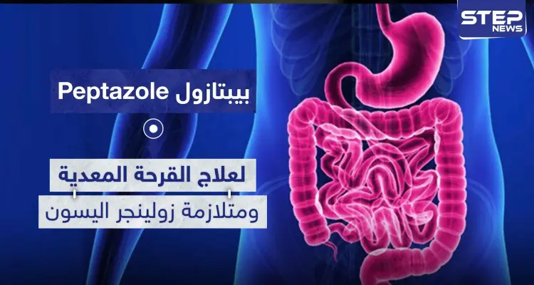 بيبتازول Peptazole لعلاج القرحة المعدية ومتلازمة زولينجر اليسون: أخبار