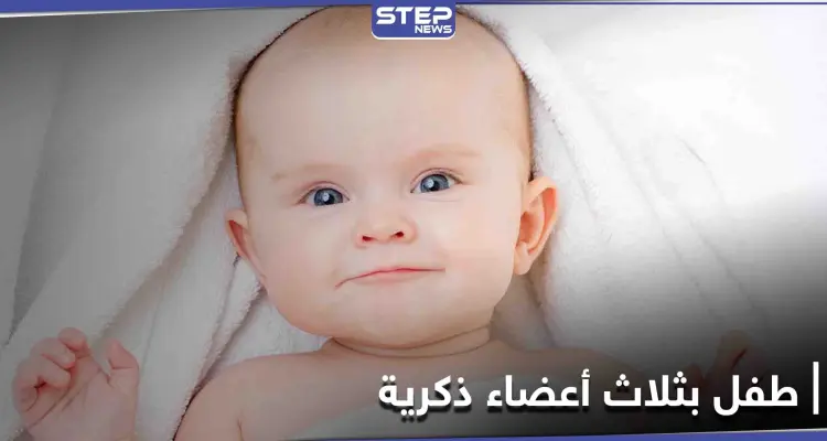 طفل عراقي بـ "3 أعضاء ذكريّة" كأول حالة مُسجلة في العالم: أخبار