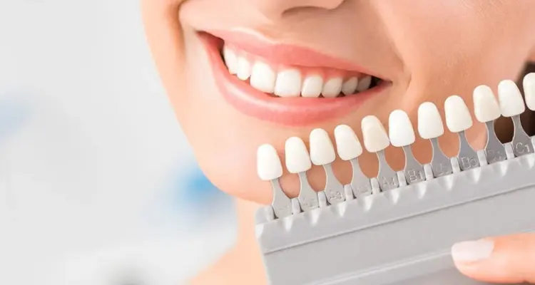 3 طرق منزلية للتخلص صفار الأسنان وطريقة تنظيف الأسنان الصحيحة: أخبار