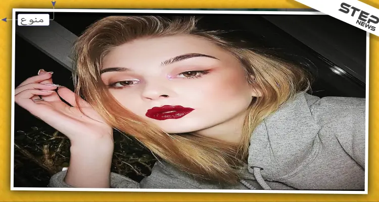 صور || "شفاه الأخطبوط" موضة جديدة في جراحة التجميل للفتيات: أخبار