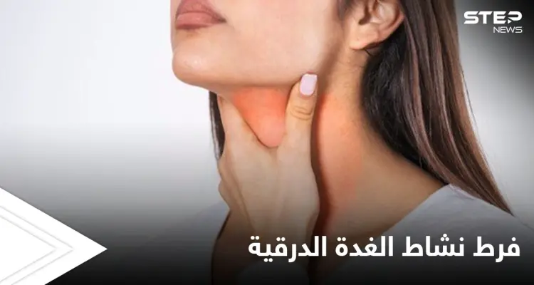 أهم الأعشاب لعلاج فرط نشاط الغدة الدرقية تعرف عليها: أخبار