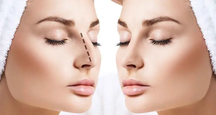 طريقة عملية تجميل الانف وخطوات إجرائها بالتفصيل.. فوائد وأضرار: أخبار