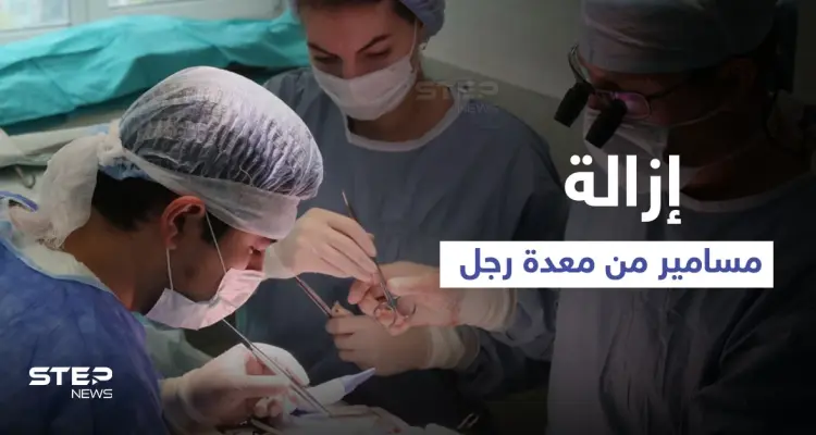 عملية جراحية معقدة لرجل ابتلع المسامير والبراغي لشهر كامل والسبب الكحول (صورة): أخبار