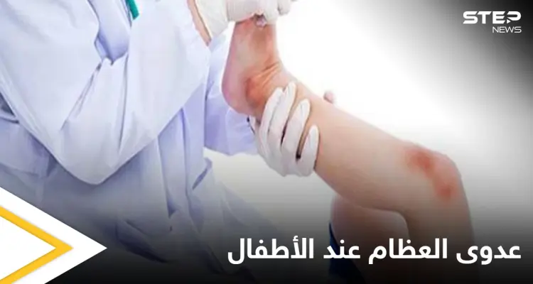 هل تصل الجراثيم إلى العظام وماهي عدوى العظام والمفاصل وخطورتها على الأطفال إليك أهم المعلومات: أخبار