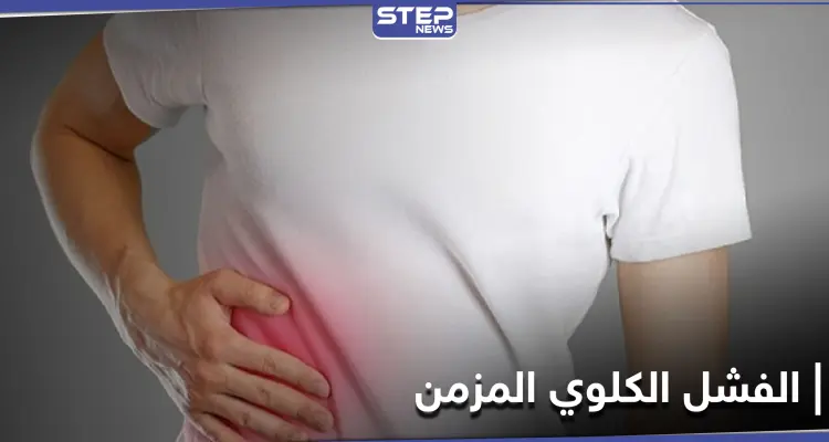 تعرف على مرض الفشل الكلوي المزمن وعلاقة زيادة الوزن به: أخبار